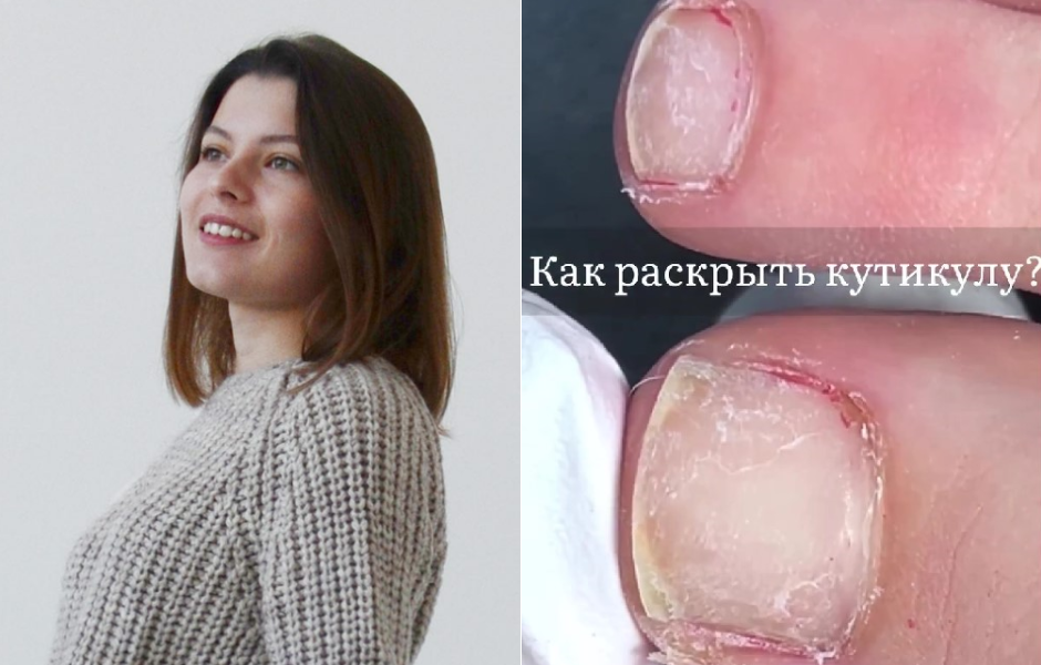 @anastasiaa.kozlova: Natural toenails. How to create a cuticle for further work?